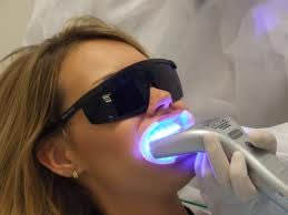 Clareamento Dental a laser ou led