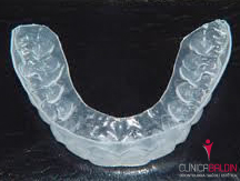 Moldeiras de silicone utilizadas em clareamento dental caseiro supervisionado